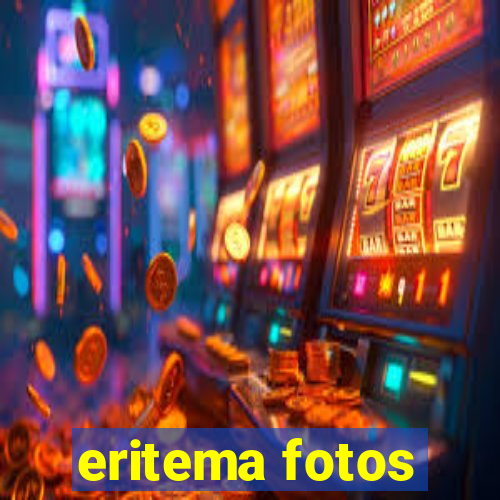 eritema fotos