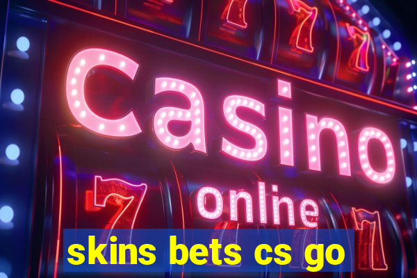 skins bets cs go