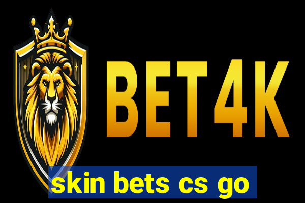 skin bets cs go